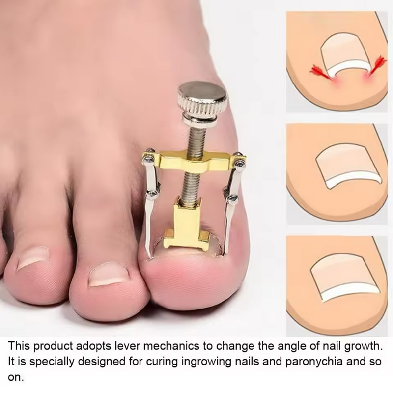 دستگاه اصلاح فرم و ارتودنسی ناخن مدل Nails